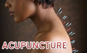 acupuncture-benefits